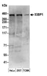 Detection of human and mouse 53BP1 by western blot.