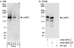 Detection of human LARP1 by western blot and immunoprecipitation.