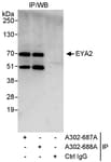 Detection of human EYA2 by western blot of immunoprecipitates.