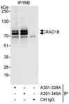 Detection of human RAD18 by western blot of immunoprecipitates.