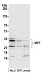 Detection of human MFF by western blot.