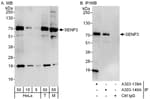 Detection of human and mouse SENP3 by western blot (h &amp; m) and immunoprecipitation (h).