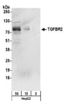 Detection of human TGFBR2 by western blot.