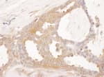 Detection of human CCT8 by immunohistochemistry.