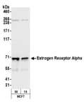 Detection of human Estrogen Receptor Alpha by western blot.