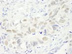Detection of human Anillin by immunohistochemistry.