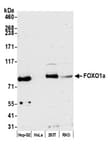 Detection of human FOXO1a by western blot.