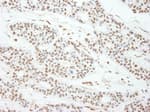 Detection of human MAD2 by immunohistochemistry.