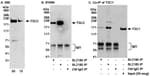 Detection of human TSC2 by western blot and immunoprecipitation and Co-IP of TSC1 with TSC2.