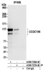 Detection of human CCDC186 by western blot of immunoprecipitates.