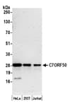 Detection of human C7ORF50 by western blot.