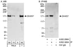 Detection of human DHX57 by western blot and immunoprecipitation.