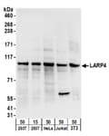Detection of human and mouse LARP4 by western blot.