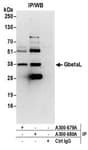 Detection of human GbetaL by western blot of immunoprecipitates.