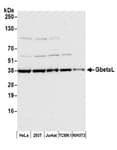Detection of human and mouse GbetaL by western blot.