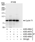 Detection of human Cyclin T1 by western blot of immunoprecipitates.