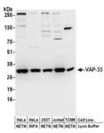Detection of human and mouse VAP-33 by western blot.