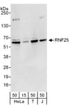 Detection of human RNF25 by western blot.
