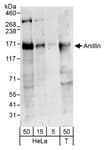 Detection of human Anillin by western blot.