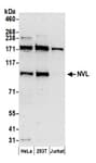 Detection of human NVL by western blot.