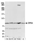 Detection of human CIP2A by western blot.