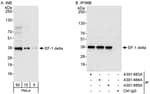 Detection of human EF-1 delta by western blot and immunoprecipitation.