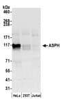 Detection of human ASPH by western blot.