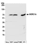 Detection of human and mouse WDR21A by western blot.