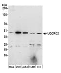 Detection of human and mouse UQCRC2 by western blot.