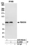 Detection of human FBXO30 by western blot of immunoprecipitates.
