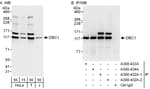 Detection of human DBC1/p30 DBC by western blot and immunoprecipitation.