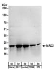 Detection of human and mouse MAD2 by western blot.