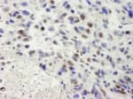Detection of mouse hSET1 by immunohistochemistry.