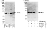Detection of human Pat1b by western blot and immunoprecipitation.