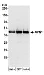 Detection of human GPN1 by western blot.