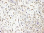 Detection of mouse CPSF100 immunohistochemistry.