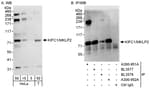 Detection of human KIFC1/MKLP2 by western blot and immunoprecipitation.