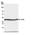 Detection of human PCNA by western blot.