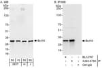 Detection of human Bcl10 by western blot and immunoprecipitation.