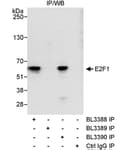 Detection of human E2F1 by western blot of immunoprecipitates.