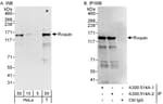 Detection of human Roquin by western blot and immunoprecipitation.