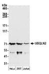 Detection of human UBQLN2 by western blot.