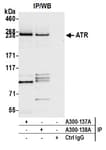 Detection of human ATR by western blot of immunoprecipitates.