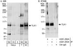 Detection of human and mouse TLK1 by western blot (h &amp; m) and immunoprecipitation (h).