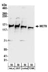 Detection of human and mouse MCT8 by western blot.
