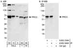 Detection of human and mouse PRCC by western blot (h&amp;m) and immunoprecipitation (h).