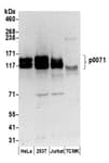 Detection of human p0071 by western blot.