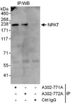 Detection of human NPAT by western blot of immunoprecipitates.