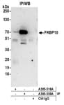 Detection of human FKBP10 by western blot of immunoprecipitates.
