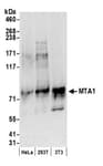 Detection of human and mouse MTA1 by western blot.